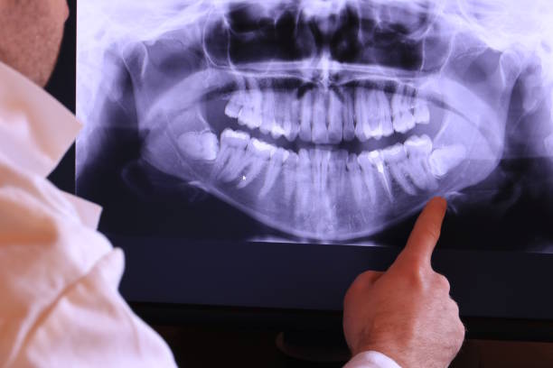 Best Emergency Treatment for Toothache in Dalzell, SC