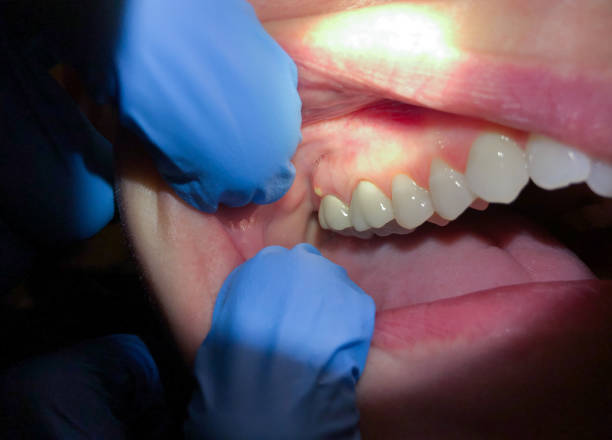 Best Emergency Dental Care for Trauma or Injury in Dalzell, SC
